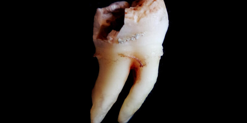 Lyukas fog Lyukas fog