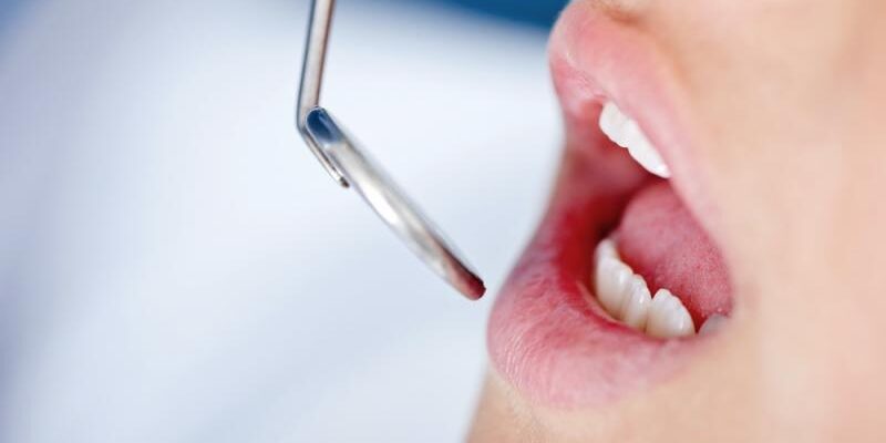 Fogvizsgálat Fogvizsgálat