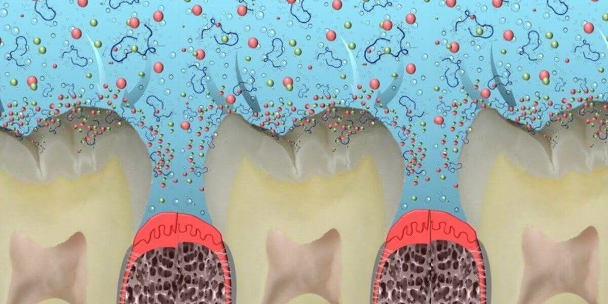 Fehérjékből újraépíthető fogzománc