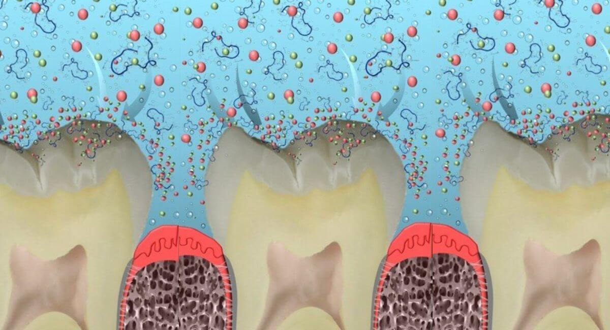 Fehérjékből újraépíthető fogzománc