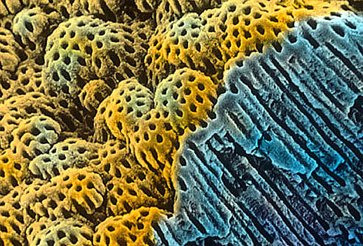 Foglepedék scanning elektronmikroszkóp alatt