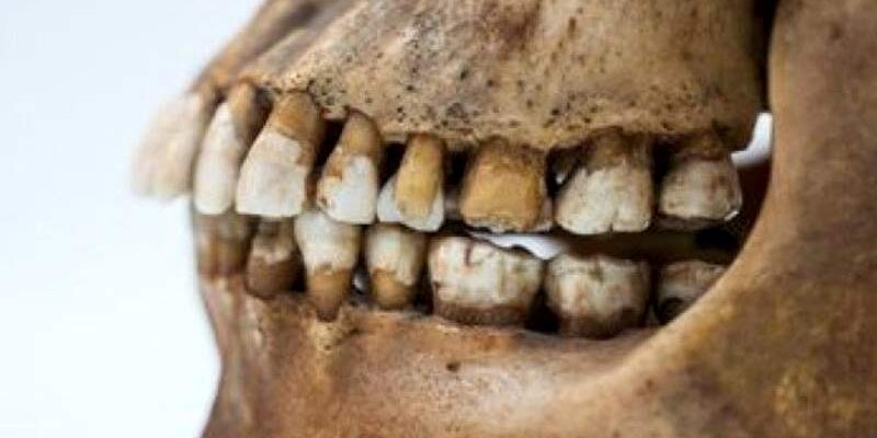 Rézkori fogak Rézkori fogak