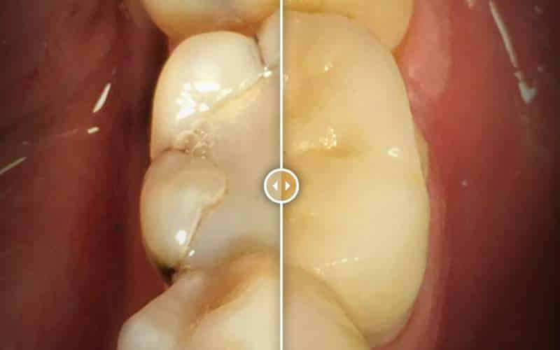 Esztétikai beavatkozás előtt és után
