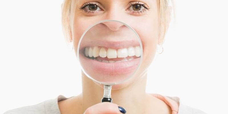 Mosoly nagyító alatt