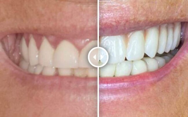 Kezelés előtt és után