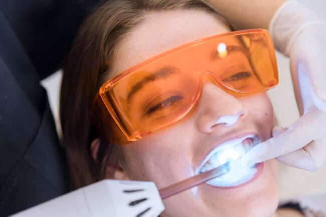 Csillogó fogak egy óra alatt!