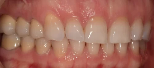 Esztétikus kezelés után