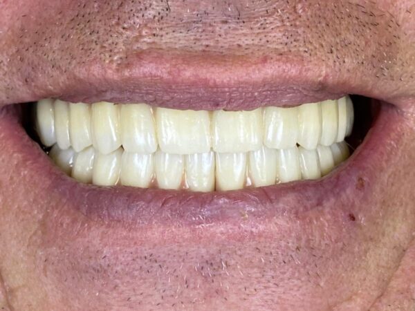 Mosolygó páciens kezelés után