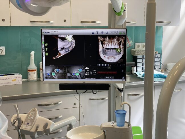 Életkép egy szájsebészeti beavatkozás előtt a Szent Lukács SPA Dental rendelőjében