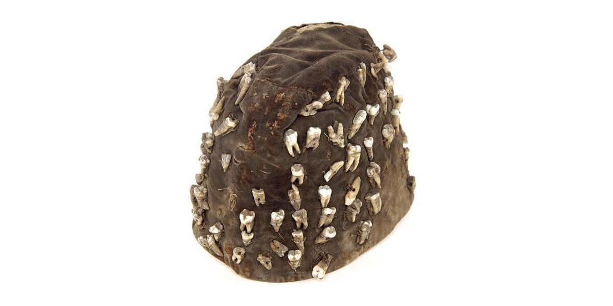 Utcai fogorvos kalapja. Utcai fogorvos kalapja.