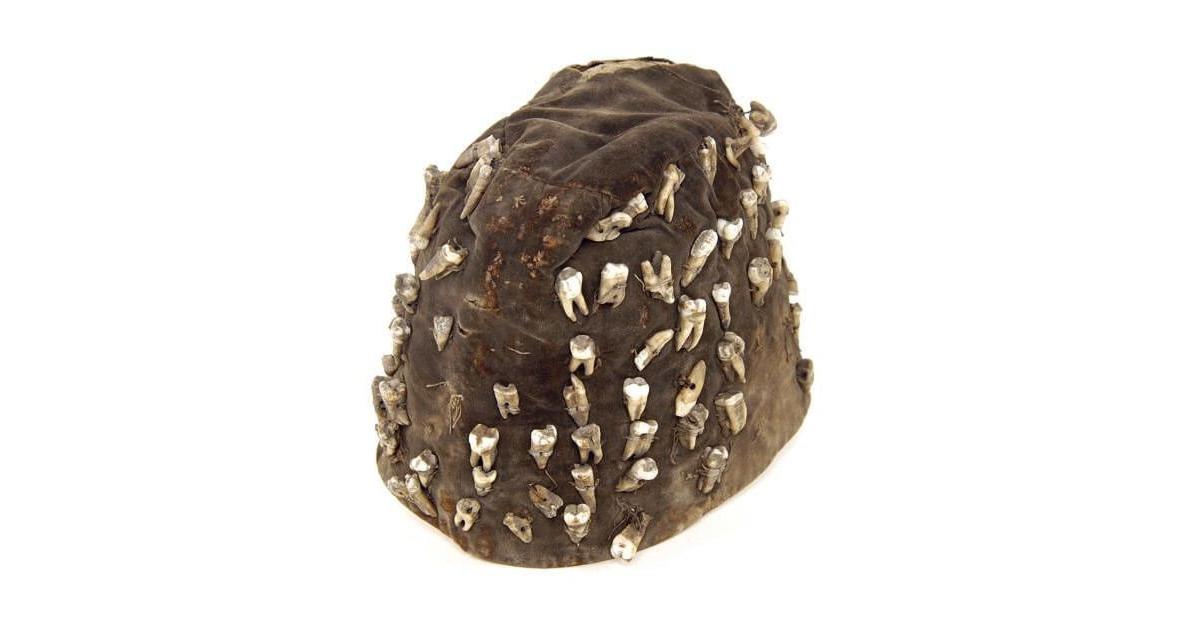 Utcai fogorvos kalapja.