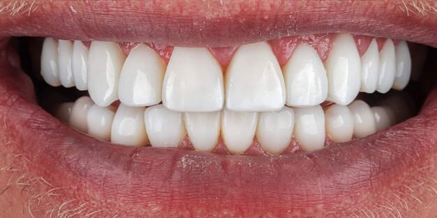 Esztétikai beavatkozás után