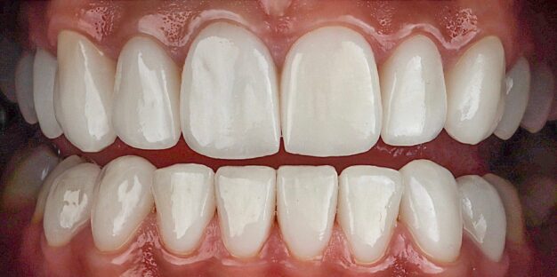 Esztétikai beavatkozás után