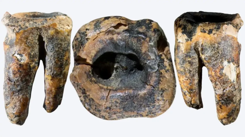 Tudománytörténeti szenzációnak számít, orosz kutatók antropológiai felfedezése. Neandervölgyi fogon gyökérkezelés nyomaira bukkantak.